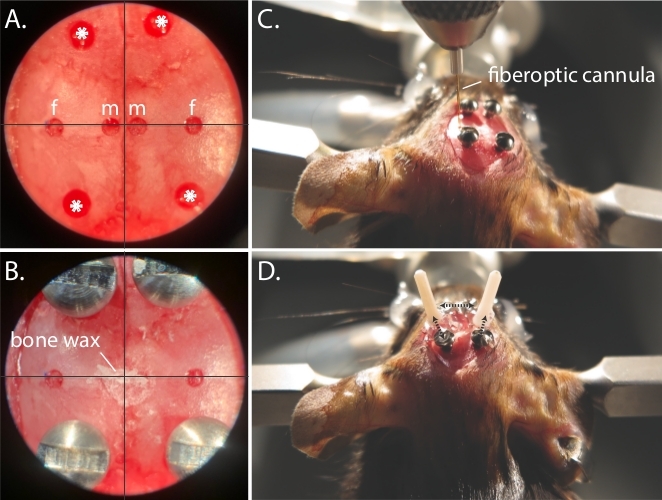 Surgical setup with fiberoptic cannula insertion in rodent skull, microscopy and alignment steps.