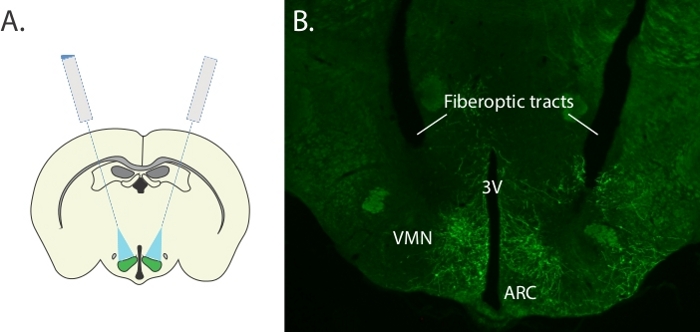 Neuroscience fiberoptic tracts; brain diagram and fluorescence microscopy of hypothalamic regions.