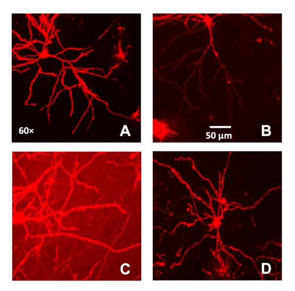 figure-results-1 Fluorescence microscopy of neuronal dendrites, showing branching patterns at 60× magnification.