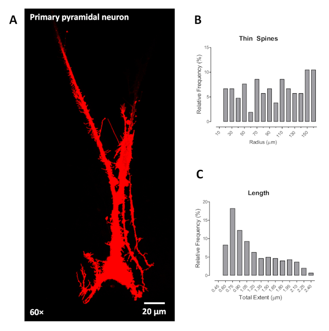 figure-results-4 Primary pyramidal neuron visualization; bar charts of spine radius and length distribution data.