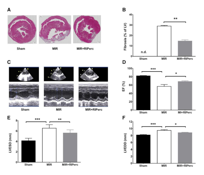 Cardiac fibrosis and function analysis; histology images and echocardiography data with graphs.