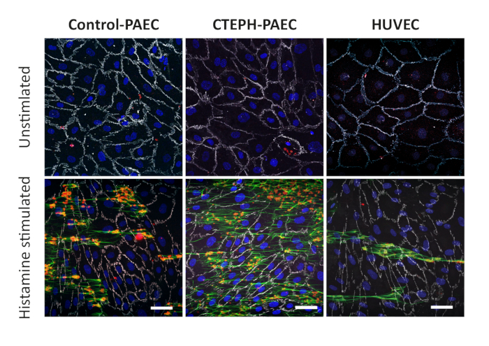 Histamine-stimulated cell microscopy, PAEC vs HUVEC, fluorescence, endothelial cell response analysis.