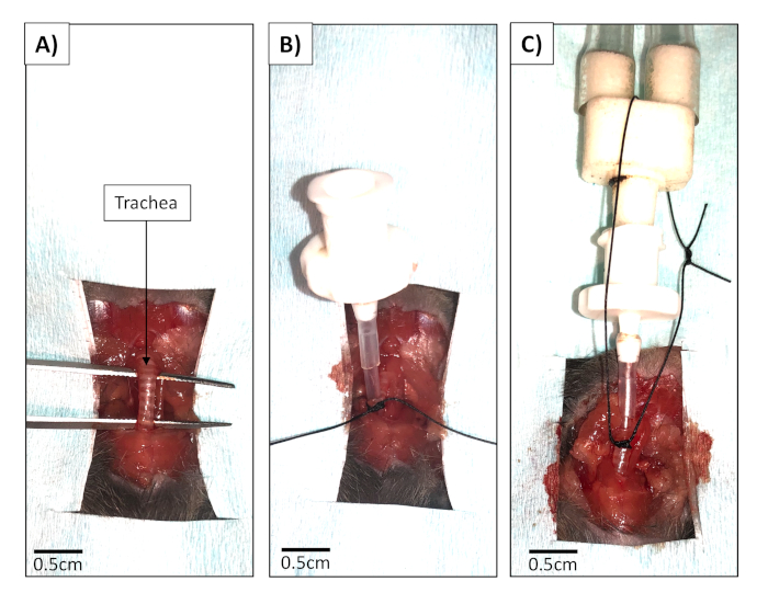 figure-results-3 Tracheotomy procedure steps, labeled images A-C, showing incision, tube insertion, securing trachea.