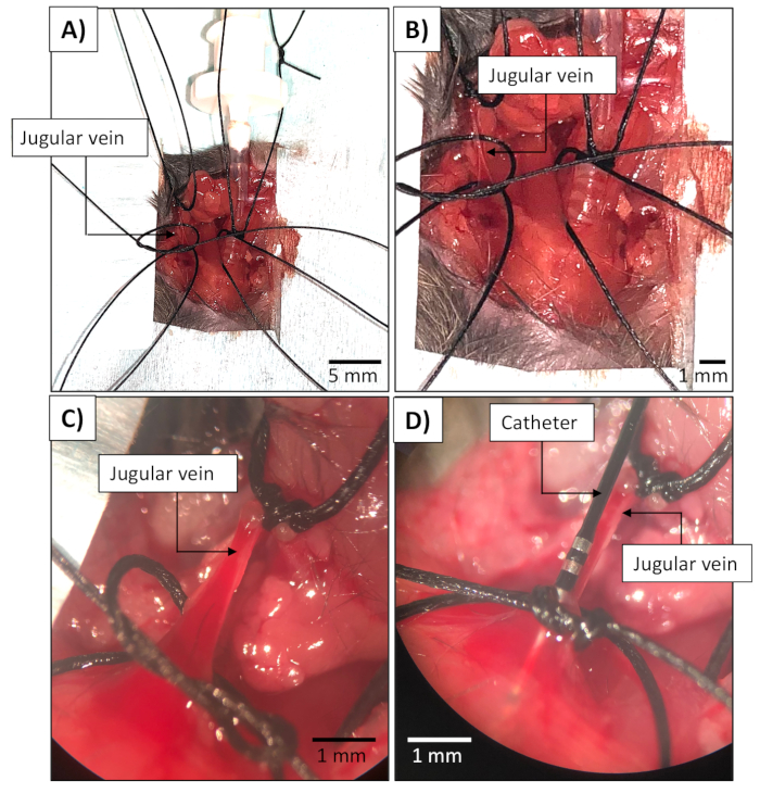 figure-results-4 Jugular vein dissection procedure; labeled microscope images show catheter insertion in surgical setup.