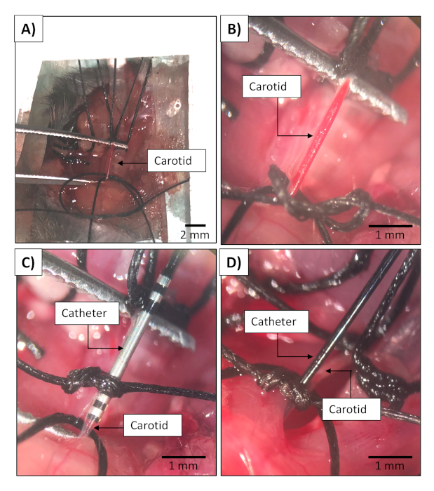 figure-results-5 Surgical catheterization of carotid artery; step-by-step microscopic images showing catheter placement.