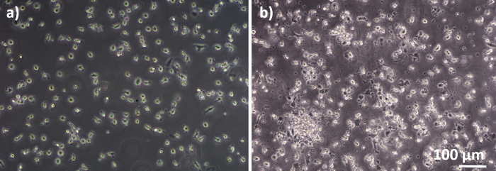 Microscope image of cell cultures, comparison of two growth conditions, scale bar included.