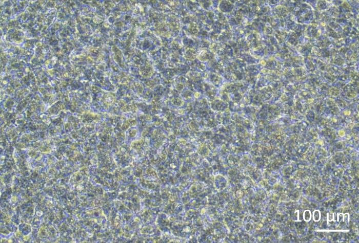 Microscope image of liver tissue cells, highlighting cellular morphology and histological features.