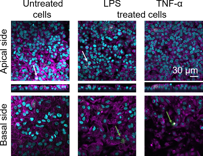 Confocal microscopy of untreated and treated cells; apical and basal views, fluorescence-labelled.