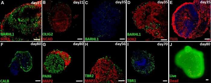 Neural differentiation timeline; immunofluorescence labeling; BARHL1, SOX2 expression patterns.