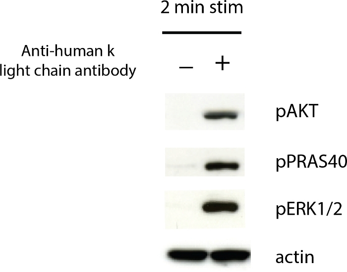 Western blot diagram, protein bands: pAKT, pPRAS40, pERK1/2, actin; anti-human k antibody.