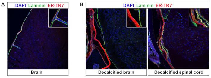 figure-results-5 Fluorescence microscopy showing DAPI, Laminin, ER-TR7 in brain, decalcified brain, spinal cord.