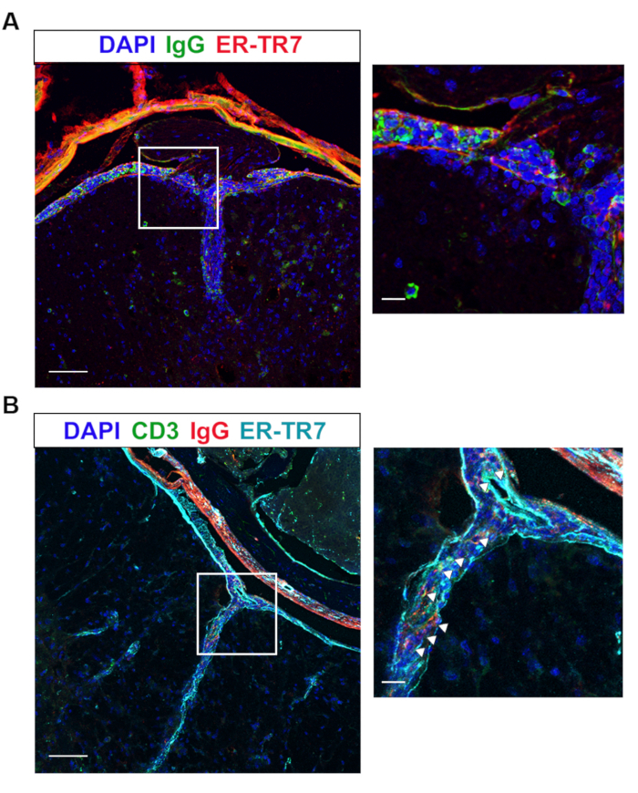 figure-results-6 Immunofluorescence diagram; DAPI, IgG, ER-TR7, CD3 markers; cellular structure analysis.