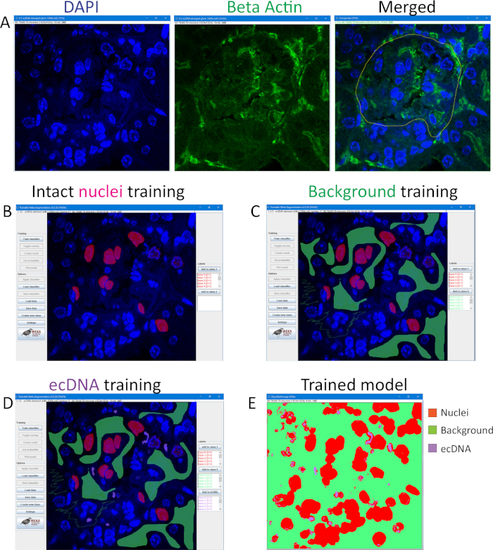 Fluorescence microscopy image analysis; DAPI and Beta Actin staining; nuclei, background, ecDNA modeling.
