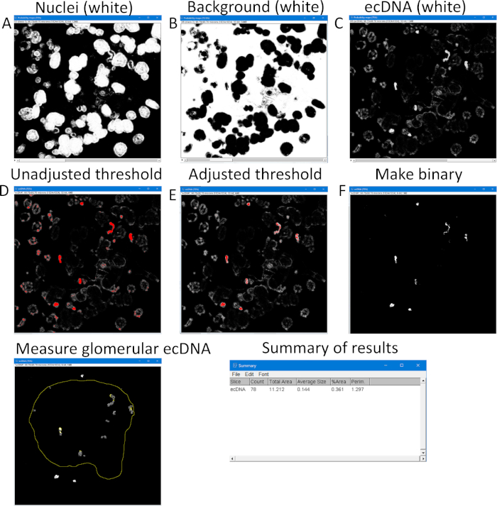 Nuclei and ecDNA thresholding process diagram; glomerular ecDNA measurement and results summary.