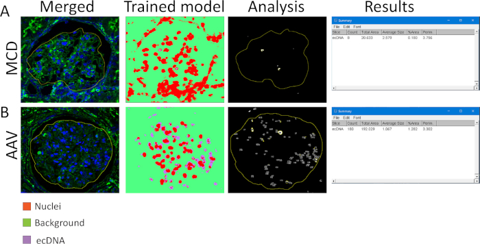 Cell segmentation analysis using machine learning; diagram shows nuclei, ecDNA in microscopy images.