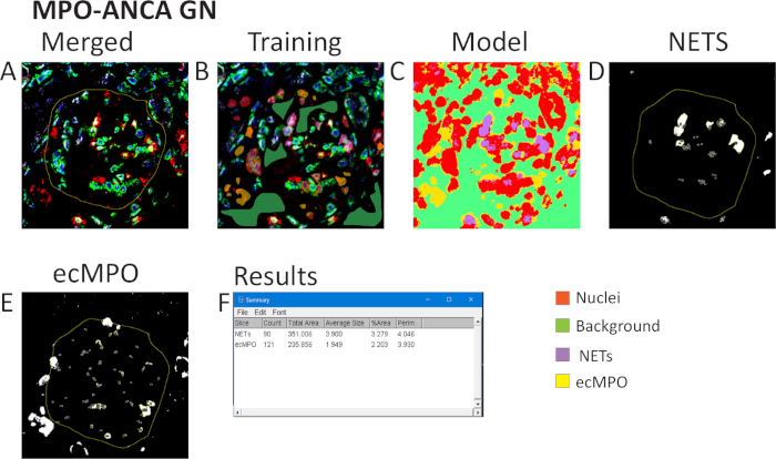 MPO-ANCA GN analysis; training, model, and results; NETs and ecMPO detection; microscopy images.