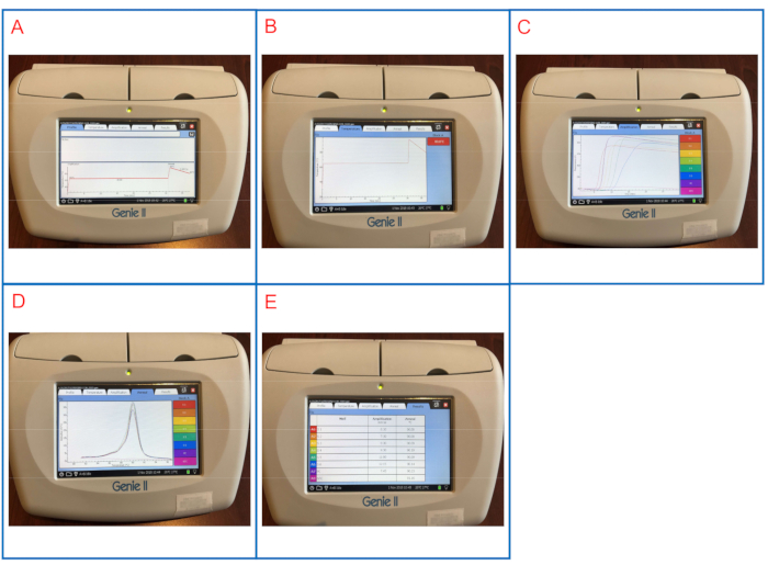 PCR workstation screens; real-time amplification curves, data analysis, thermal profile, Genie II setup.
