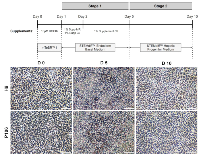 figure-results-2 Cell differentiation timeline for stem cells; microscopy of H9, P106 cells in hepatic medium.