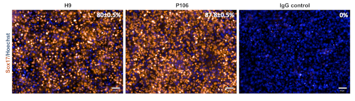 figure-results-3 Sox17/Hoechst microscopy image, cell differentiation analysis, H9, P106, and IgG control comparison.
