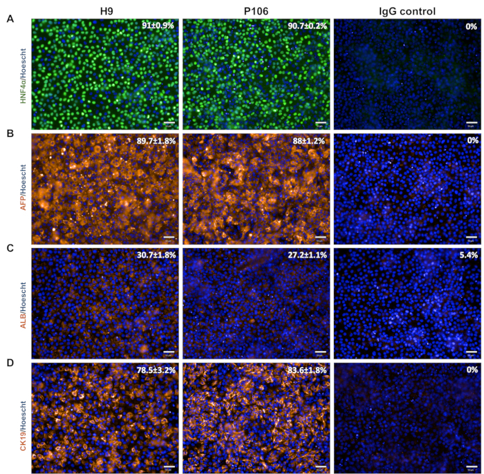 figure-results-4 Fluorescent microscopy images: protein expression in cell cultures, with IgG control comparison.
