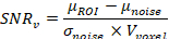 Signal-to-noise ratio equation, SNRv=μROI−μnoise/σnoise×Vvoxel, mathematical formula.