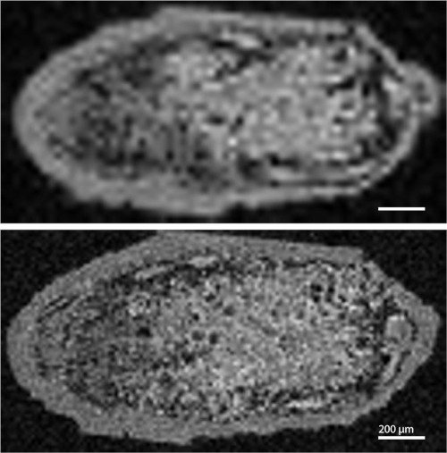 figure-results-11 Magnetic Resonance Imaging (MRI) slices, showcasing cellular structure at 200 µm resolution.
