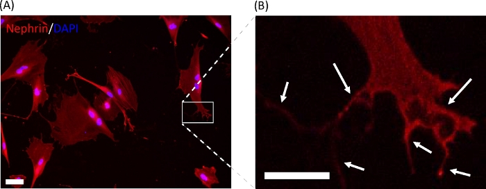 figure-results-4 显示足细胞中nephrin分布的荧光显微镜图像,DAPI染色显示蛋白定位。