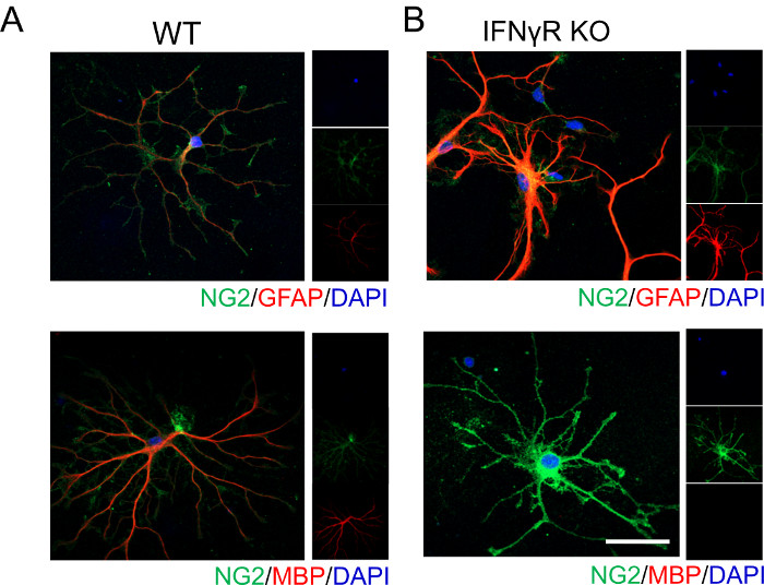 Immunofluorescence microscopy diagram of NG2, GFAP, DAPI-stained cells in WT and IFNγR KO samples.