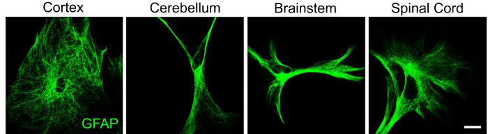 GFAP staining in cortex, cerebellum, brainstem, and spinal cord; microscopy image; neuroanatomy.