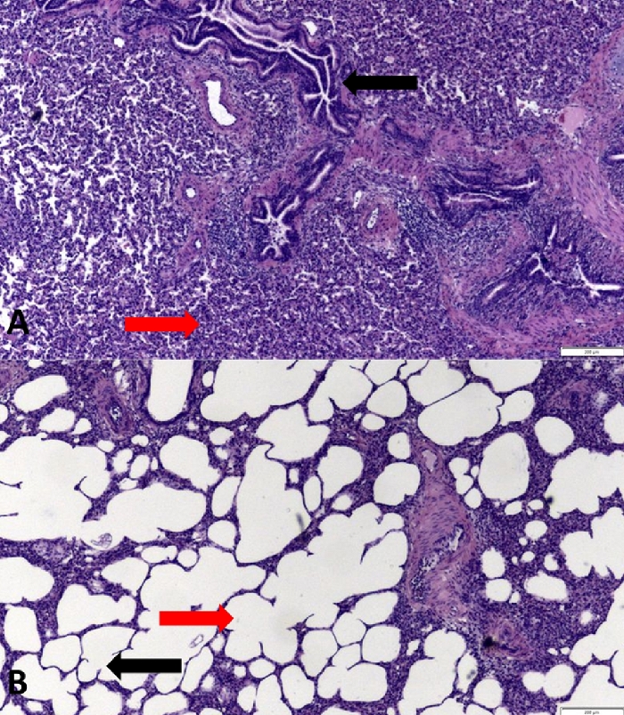 Histological comparison of lung tissues under a microscope; alveolar structure, H&E staining.