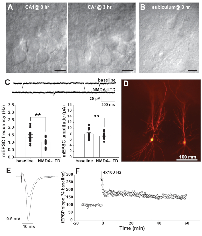 Neuroscience diagrams and graphs showing synaptic changes, electrophysiology, neuron imaging results.