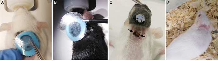 Mouse craniotomy procedure; surgical steps; neuroscience research; experimental setup.