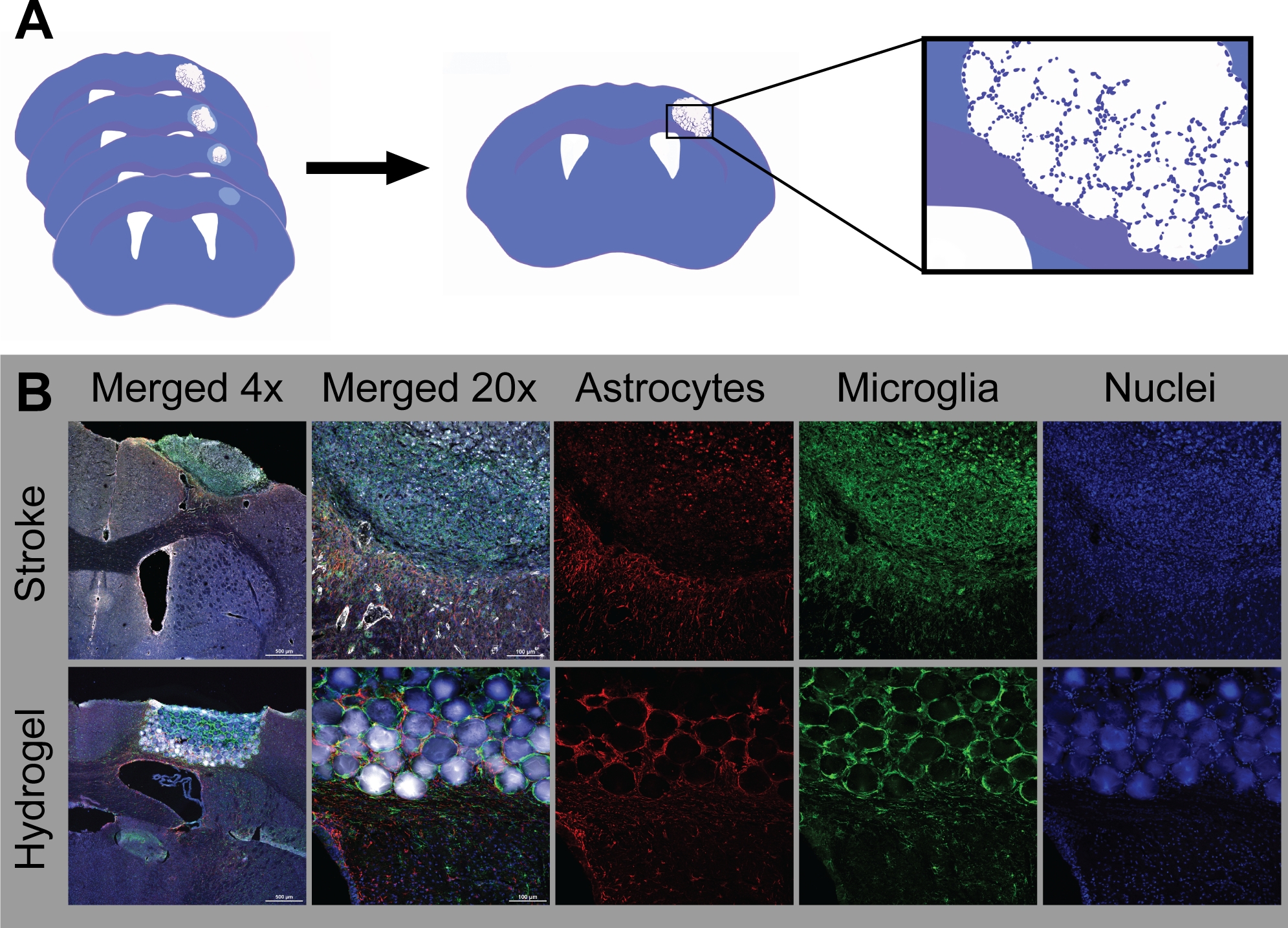 Injection of Hydrogel Biomaterial Scaffolds to The Brain After