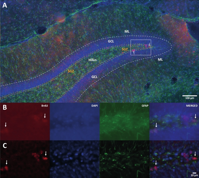 figure-introduction-1 Neurogenesis study, immunofluorescence microscopy, highlighting SGZ, GCL, ML with markers BrdU, DAPI, GFAP.