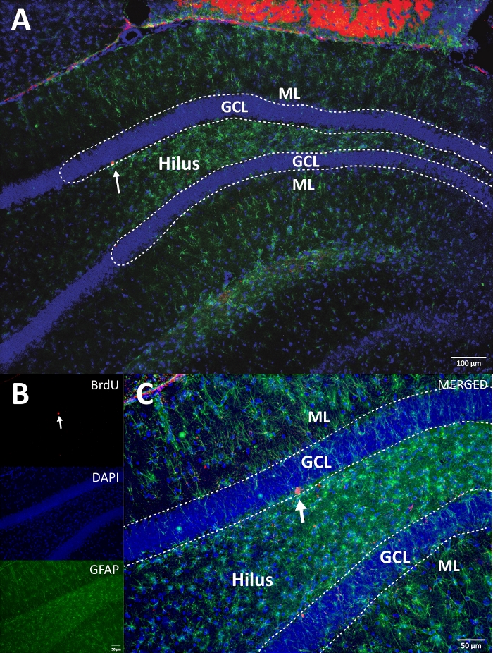 Immunofluorescence microscopy showing neural stem cells in hippocampus, DAPI, BrdU, GFAP labeling.