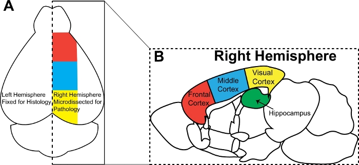 Mouse Brain Extraction Systems Analysis of the Neuroinflammatory and Hemodynamic Response to ...