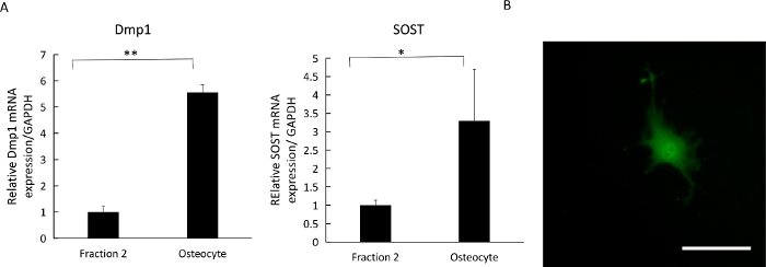 Gene expression analysis; bar graphs of mRNA in osteocytes and microscopy image of cell morphology.