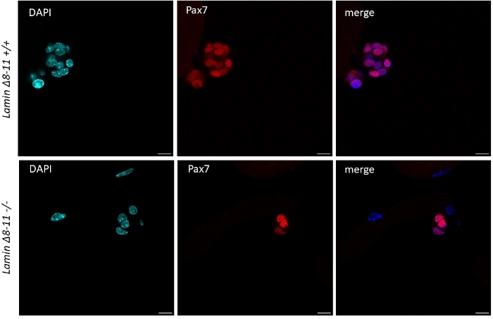 figure-results-5 Fluorescence microscopy, Lamin DAPI and Pax7 staining, cell nuclei visualization, experimental results.
