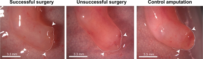 Regeneration outcomes diagram; surgical comparison, measurement scale; 3.3 mm scale bar visible.