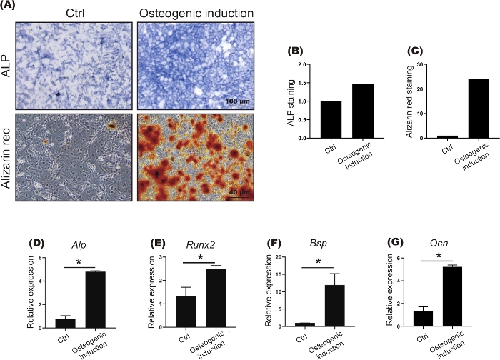 Isolation and Cultivation of Mandibular Bone Marrow Mesenchymal Stem ...