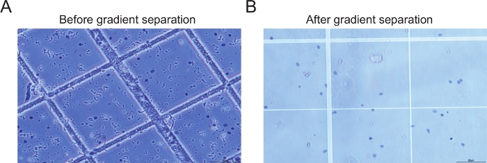 figure-results-2 Gradient separation process, microscope image; before and after cell sorting, experimental results.