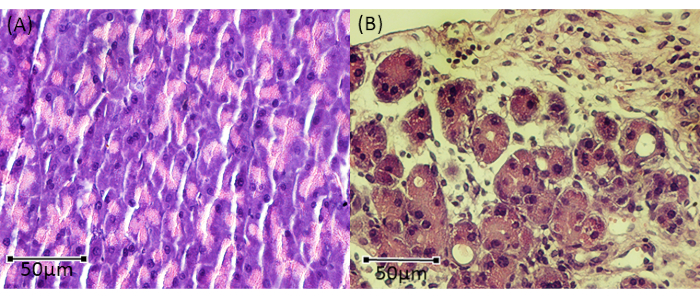 Histology heart tissue comparison, microscopy images; normal vs. diseased cardiac cells, 50μm scale.