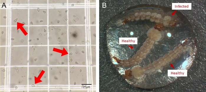 Microscopy analysis, healthy vs infected samples, grid counting cells, infection identification.