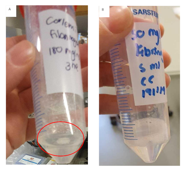 Protein precipitation experiment; centrifuge tubes with aggregates; sample analysis and separation.
