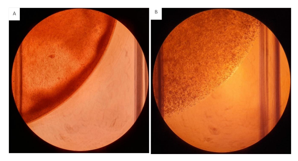 Microscope image of static equilibrium, showing solid-liquid interface, in experimental setup.