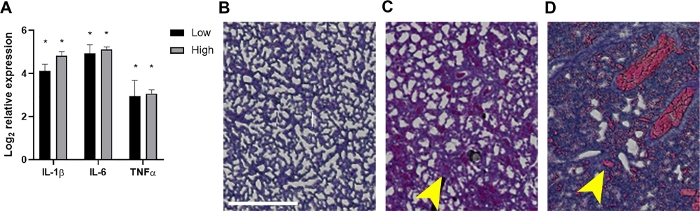 figure-results-4 基因表达分析;柱状图;IL-1β、IL-6、TNFα;组织染色;组织学比较。