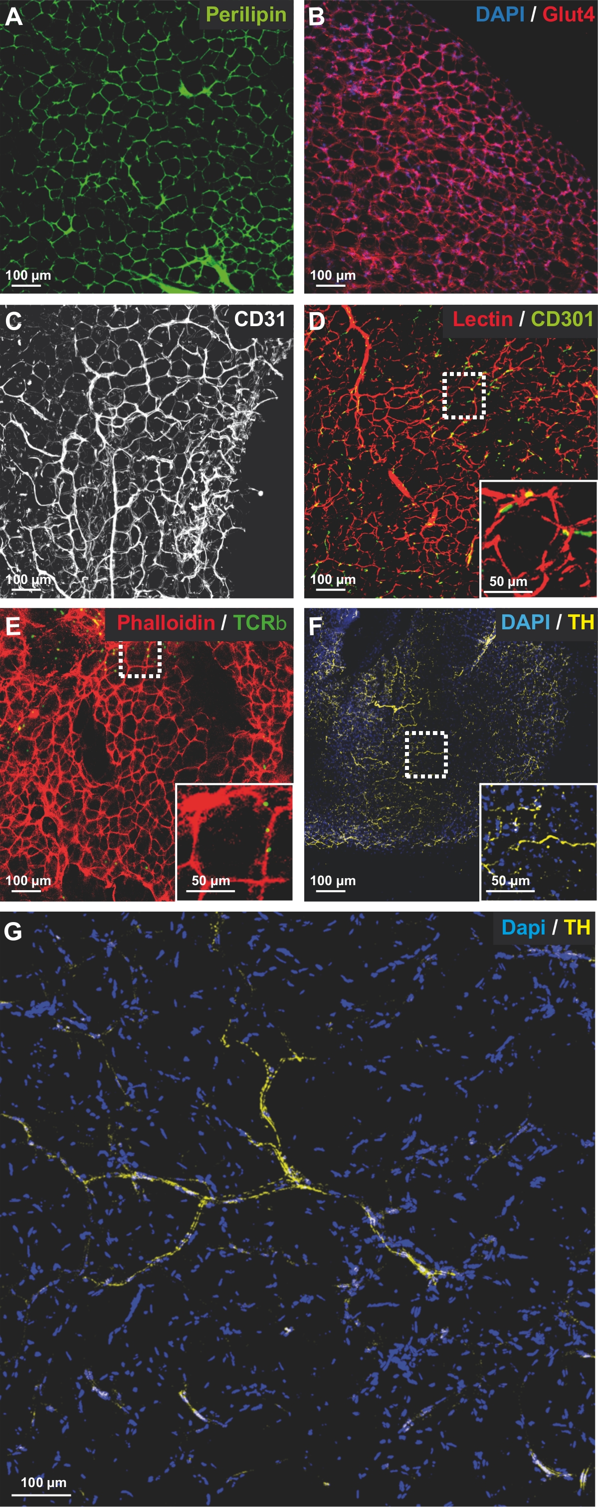 Exploring Adipose Tissue Structure by Methylsalicylate Clearing and 3D ...