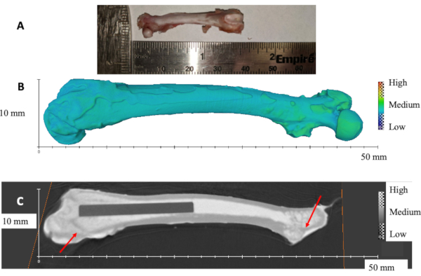 bone structural analysis; 3D bone scan, CT scan image; stress distribution, material density