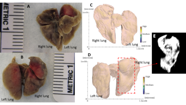 Lung tissue analysis with size comparison, 3D segmentation diagrams, and density map visualization.