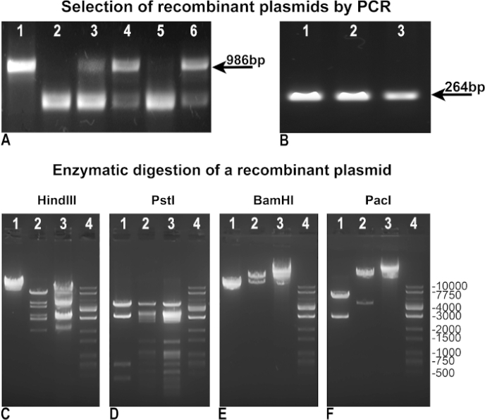 figure-results-1 PCR and enzymatic digestion gel electrophoresis of recombinant plasmids; plasmid verification analysis.